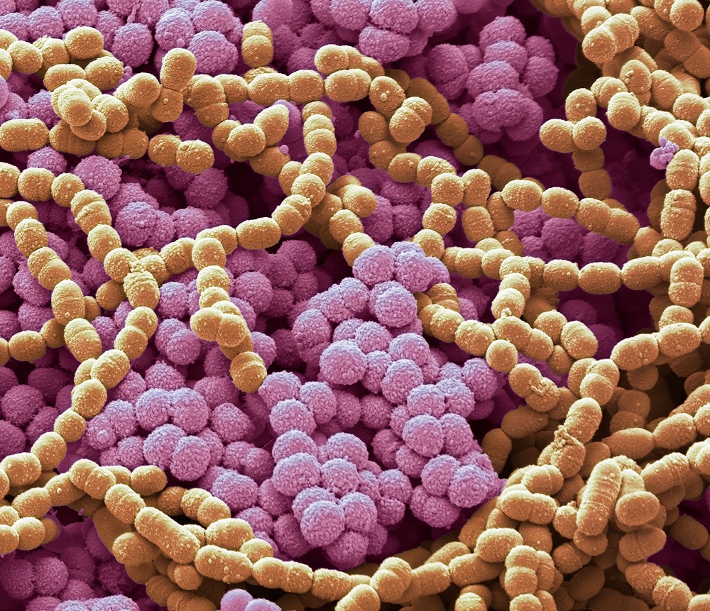 Pic of Mycobacterium made by a Scanning electron microscope and coloured.
